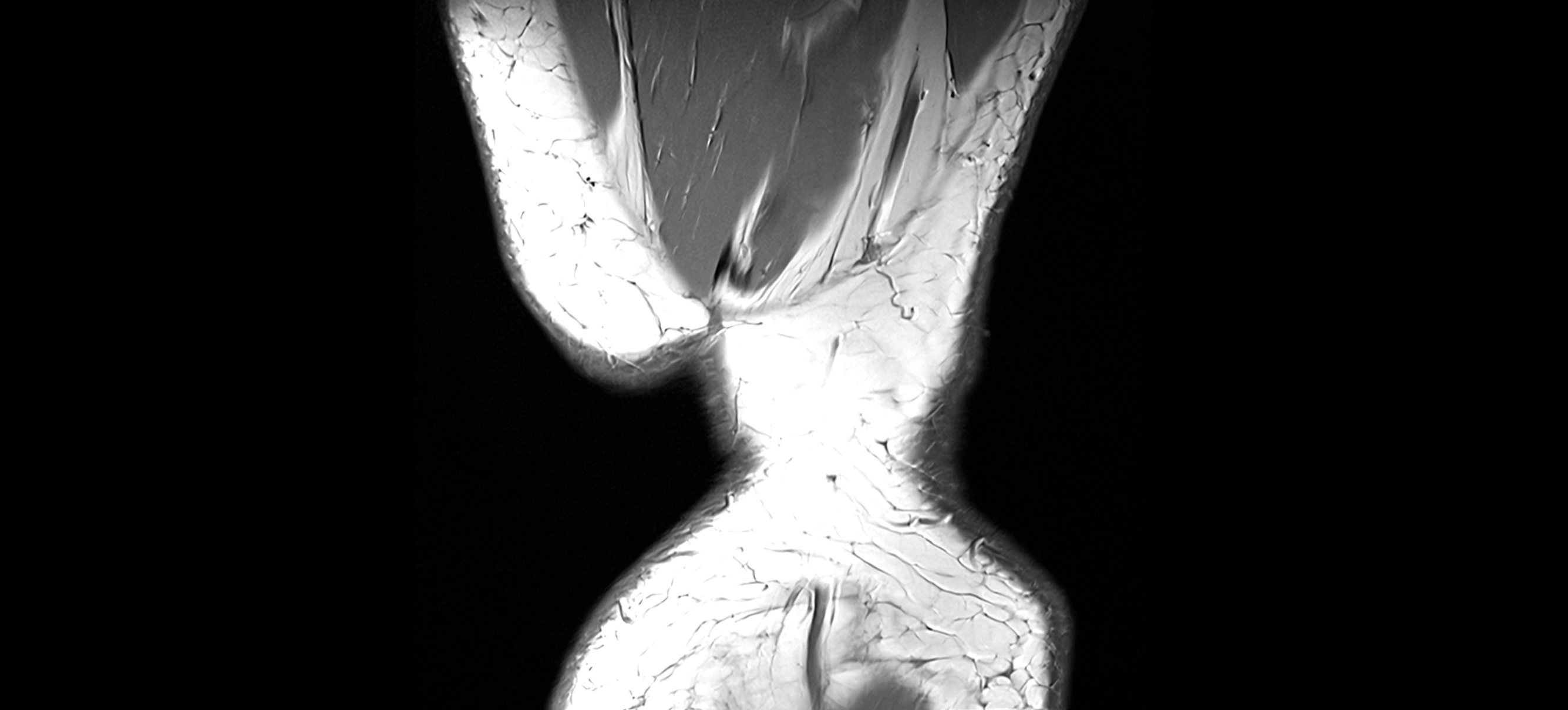 MRI coronal  ligaments cross sectional anatomy 3T  radiology  image-img-04001-00045.webp